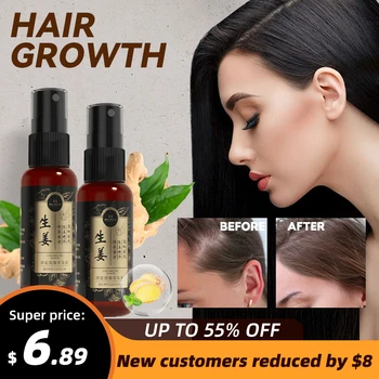 Масло-спрей для роста волос с имбирем, предотвращающее выпадение волос, Питающее кожу головы для мужчин и женщин, Эфирные масла, эффективные средства против выпадения волос